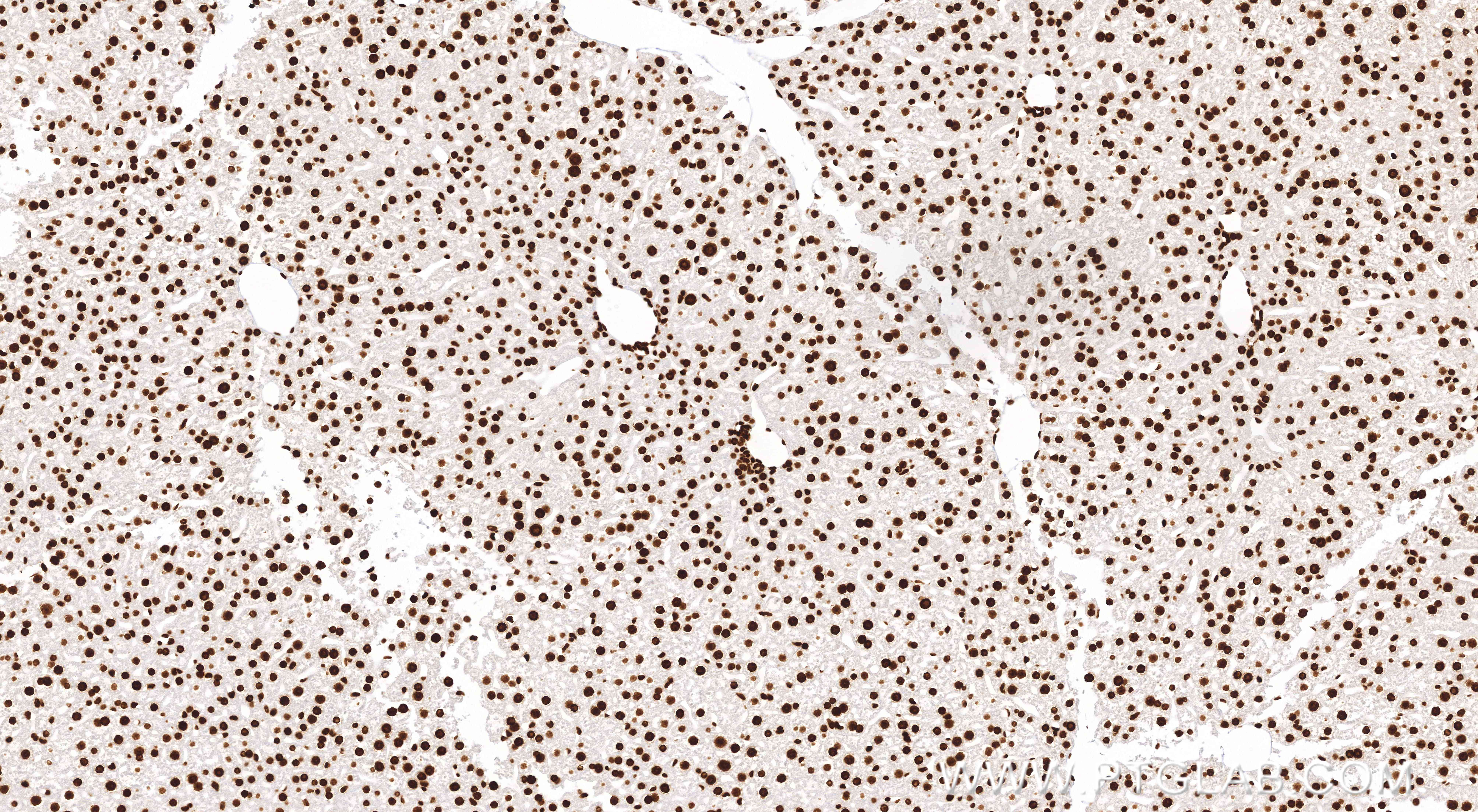 Immunohistochemical analysis of paraffin-embedded mouse liver tissue slide using 84329-1-RR (Di/Tri-Methyl-Histone H3 (Lys36) antibody) at dilution of 1:2000 (under 10x lens). Heat mediated antigen retrieval with Tris-EDTA buffer (pH 9.0). IHC staining of mouse liver using 84329-1-RR