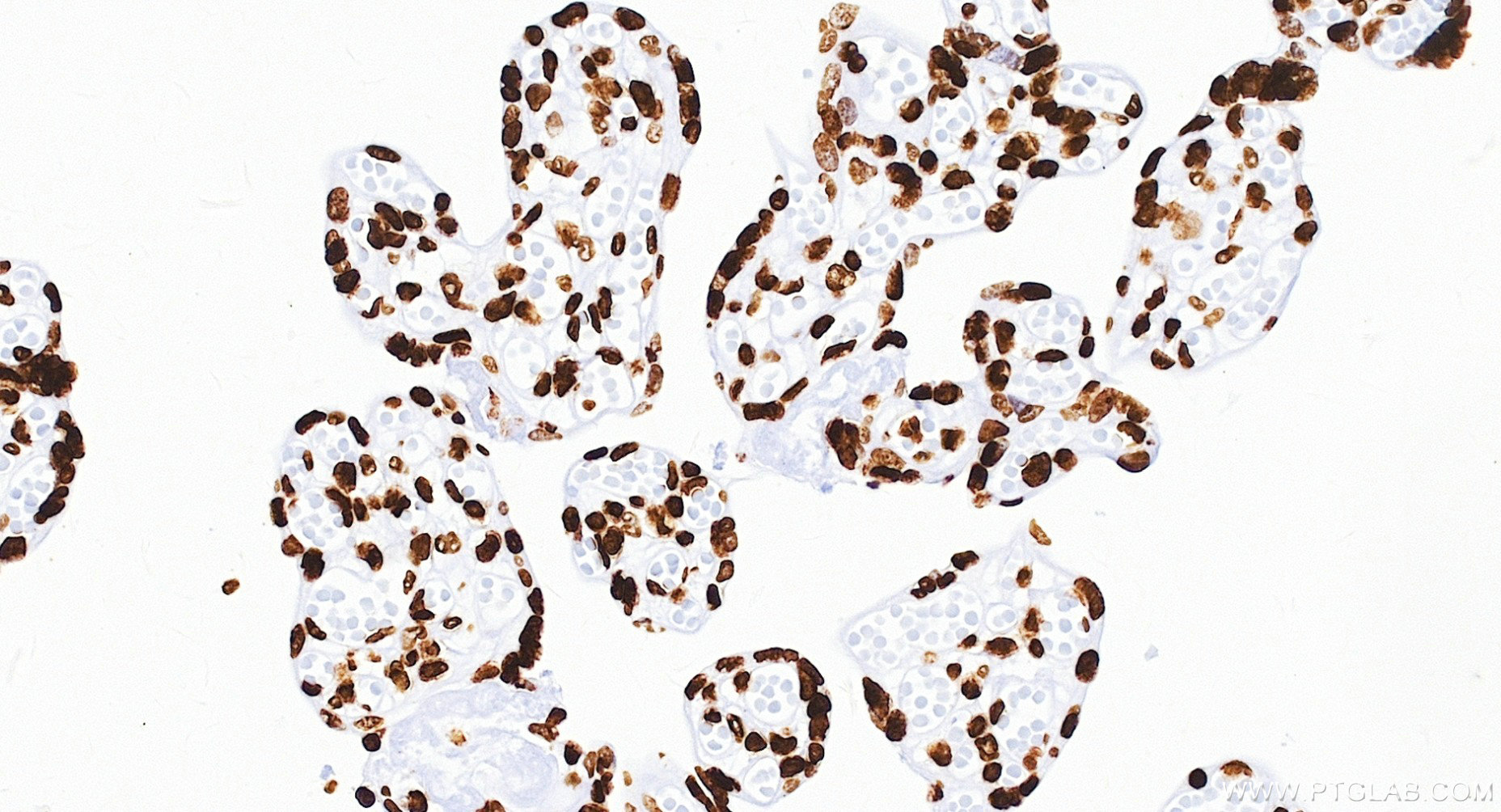 IHC staining of human placenta using 84329-6-RR IHC staining of human placenta using 84329-6-RR