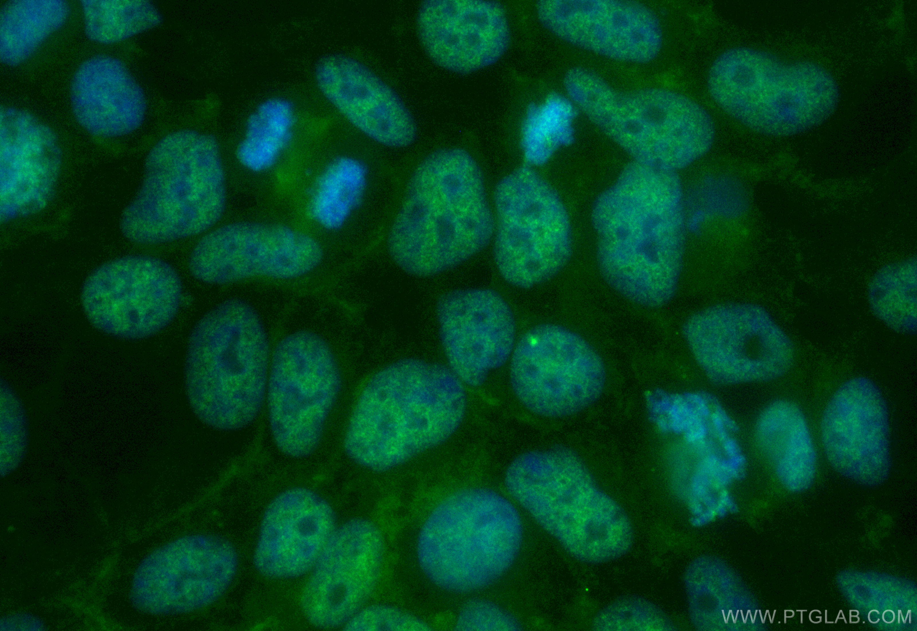 IF Staining of HEK-293 using CL488-84908-2