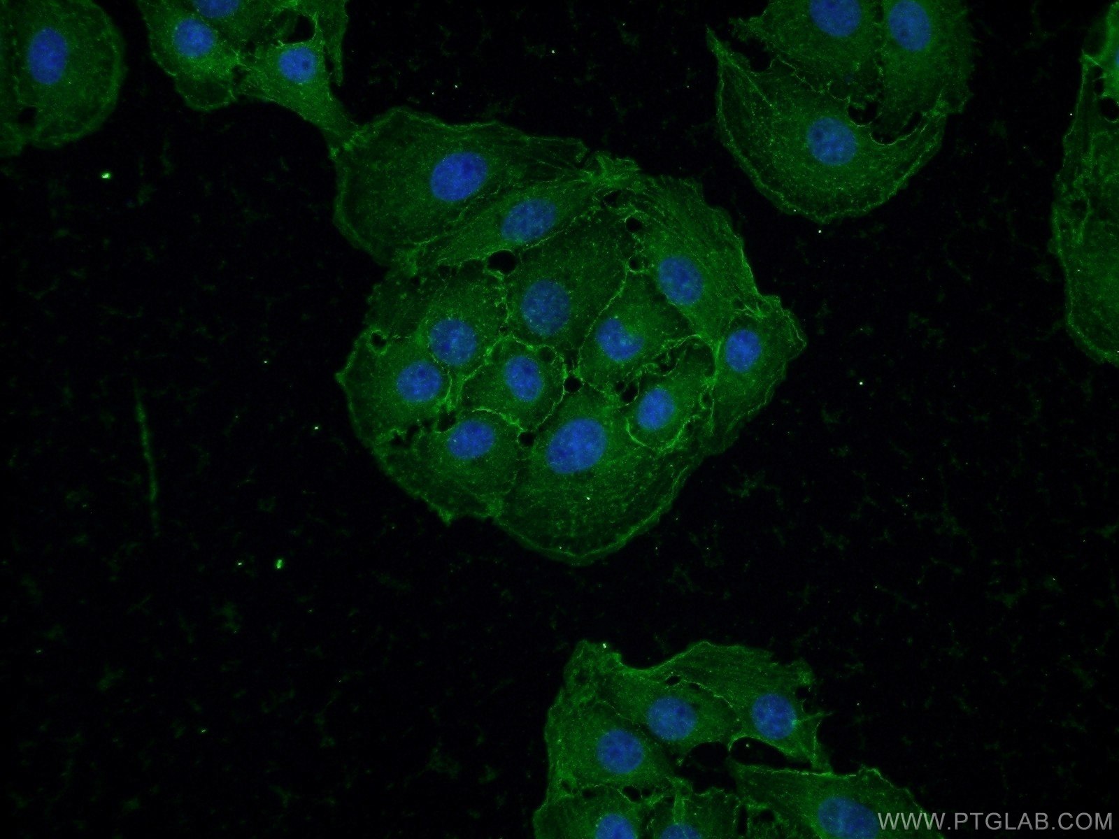 IF Staining of SH-SY5Y using 25770-1-AP