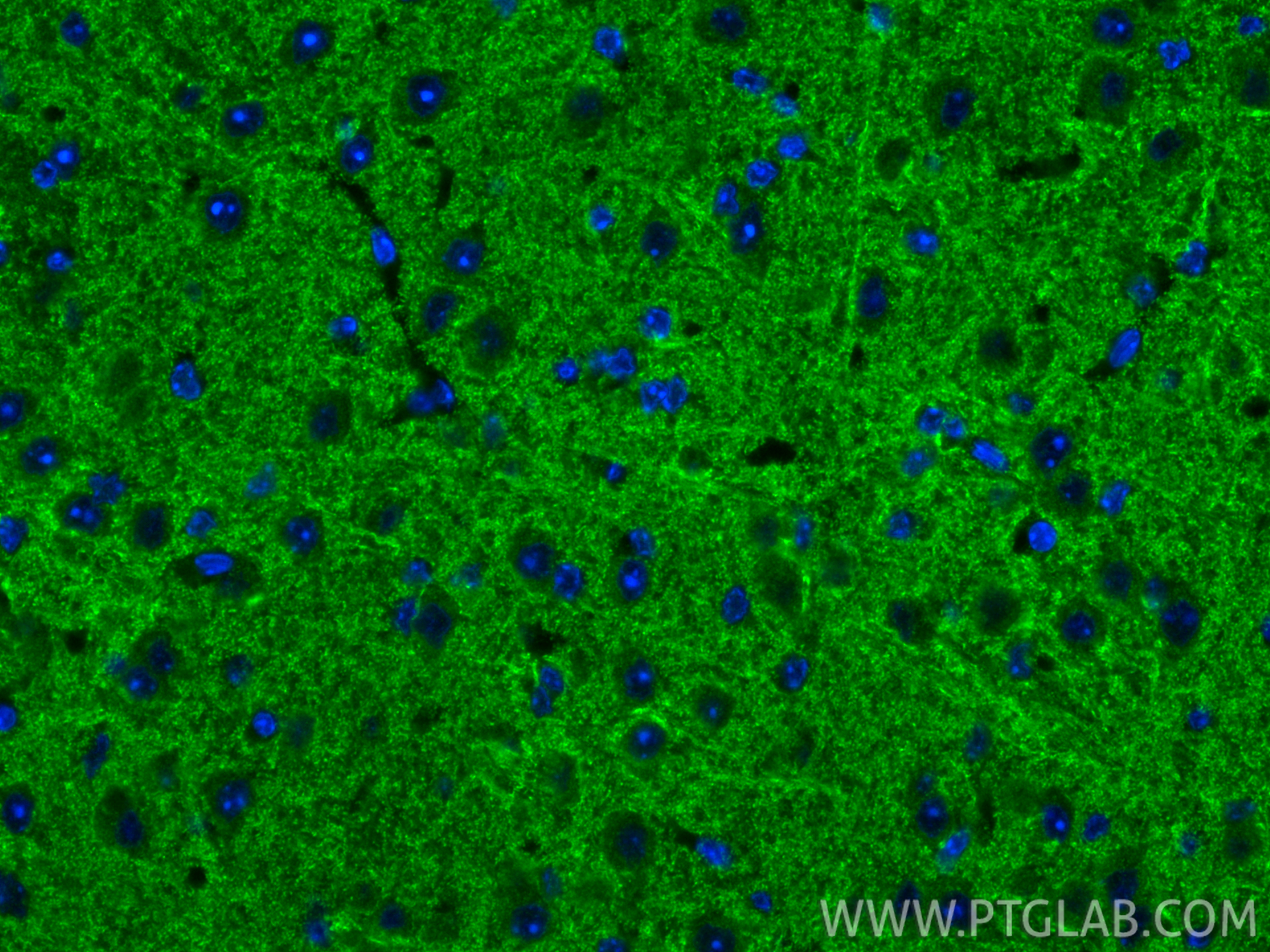 IF Staining of mouse brain using 83591-2-RR (same clone as 83591-2-PBS)