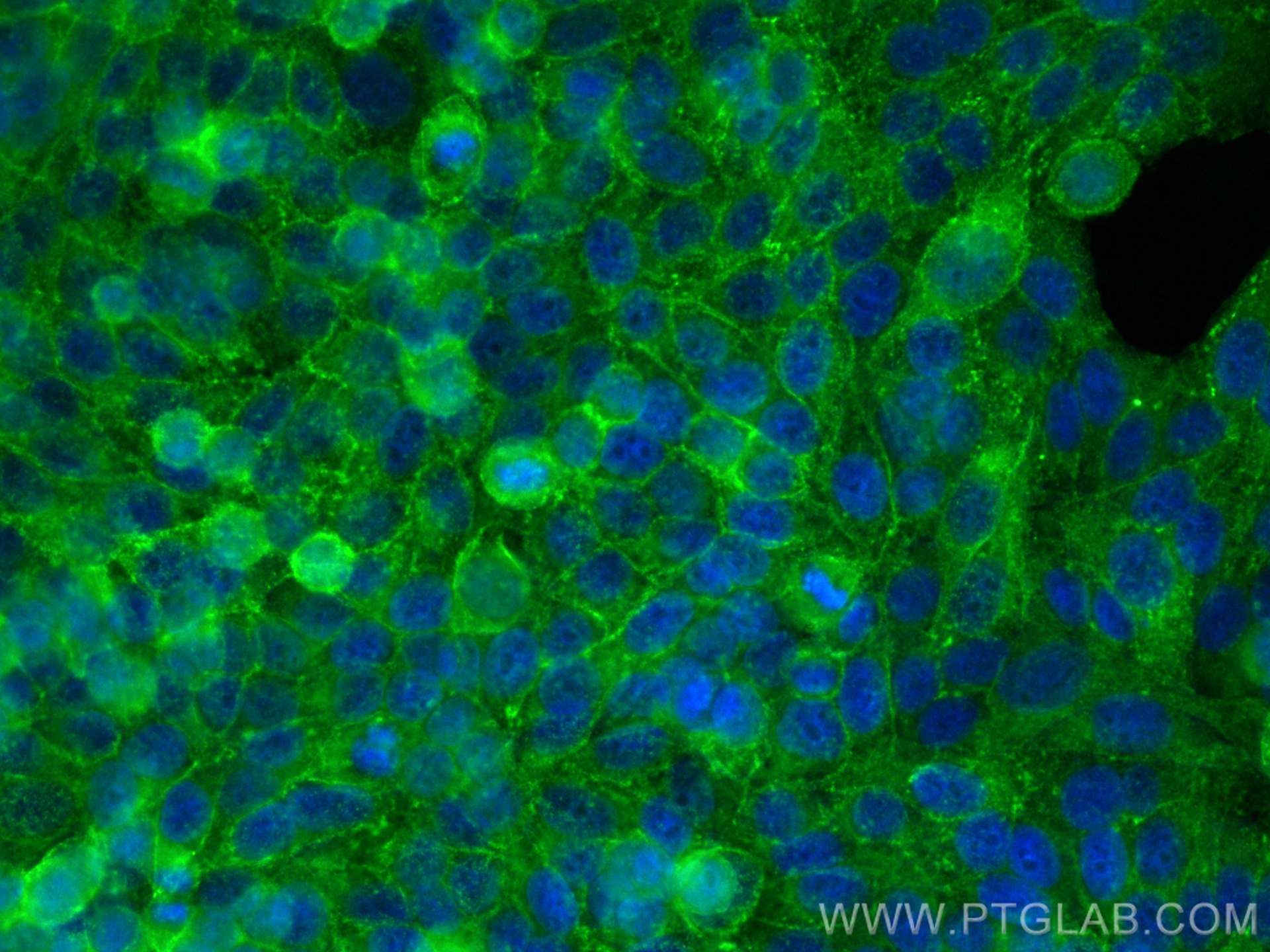 IF Staining of HepG2 using CL488-10260