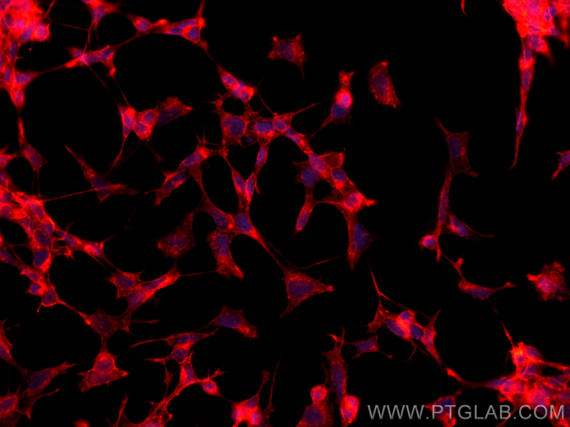 IF Staining of SH-SY5Y using CL594-67589