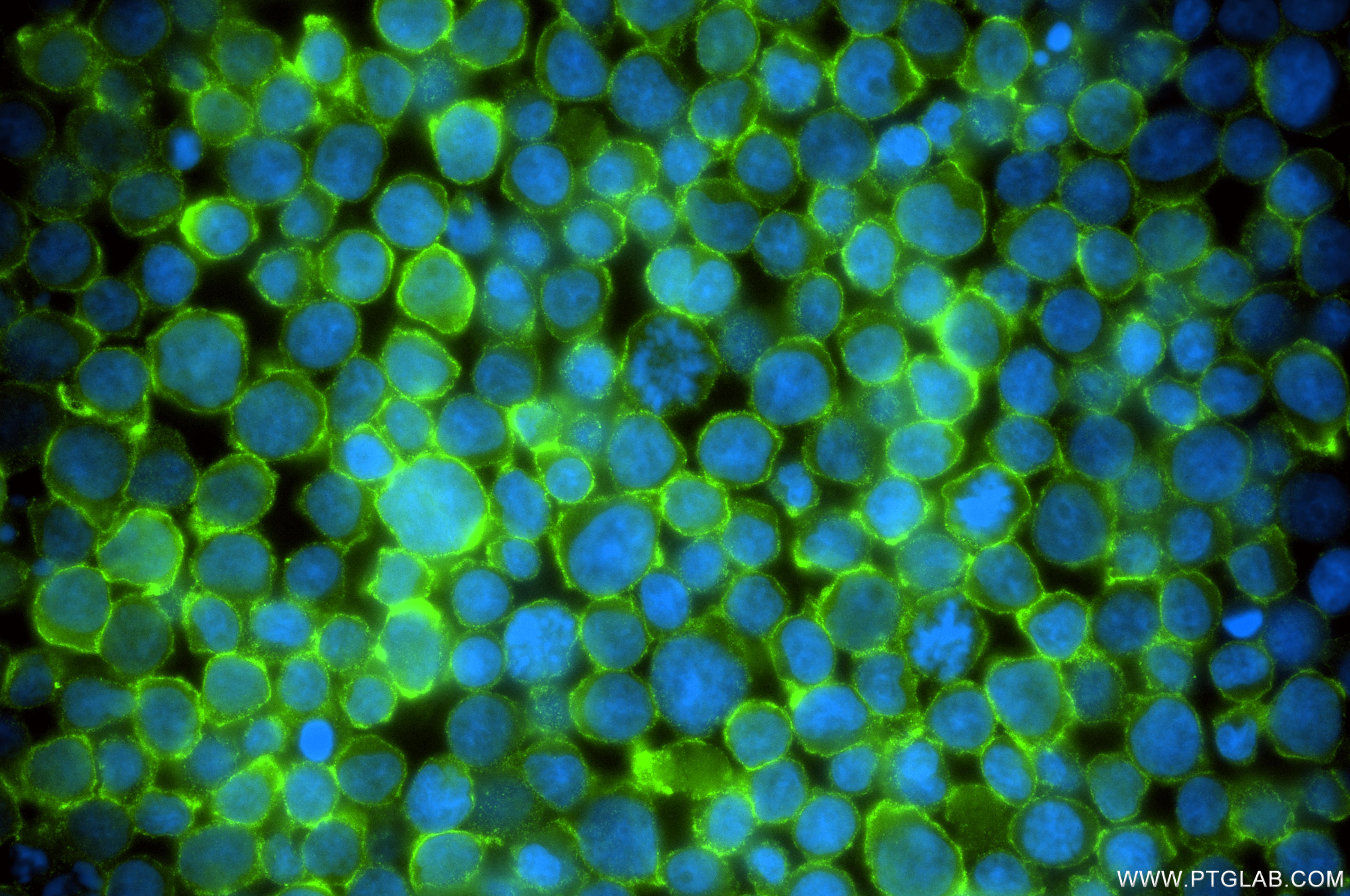 IF Staining of Jurkat using 85025-6-RR