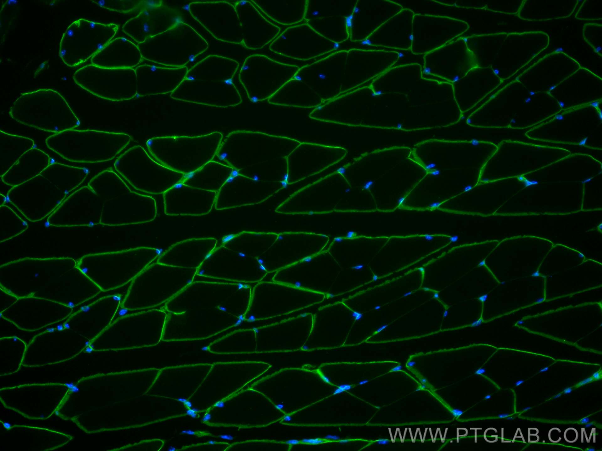 IF Staining of mouse skeletal muscle using 68120-1-Ig (same clone as 68120-1-PBS)