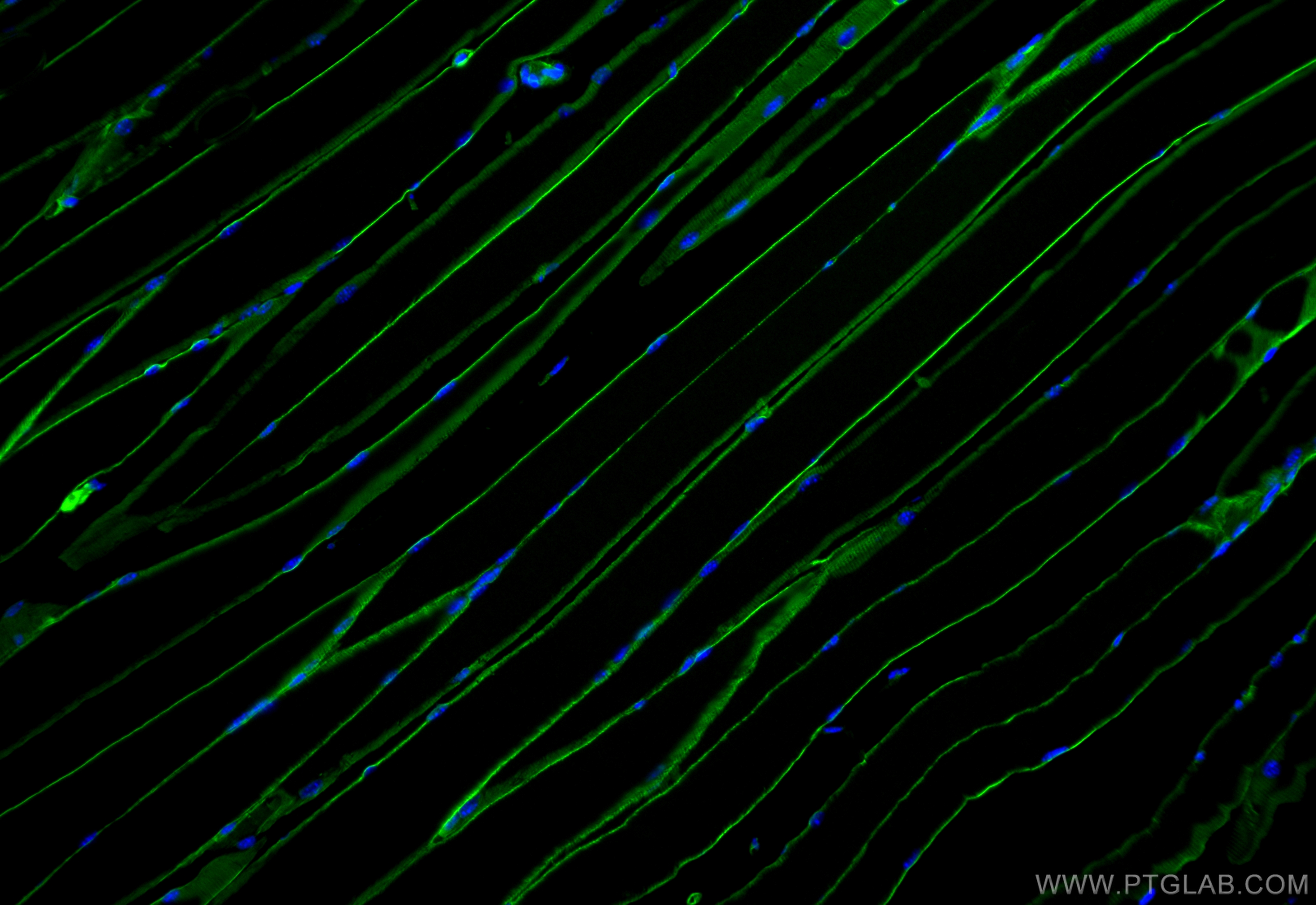 IF Staining of mouse skeletal muscle using 68120-1-Ig