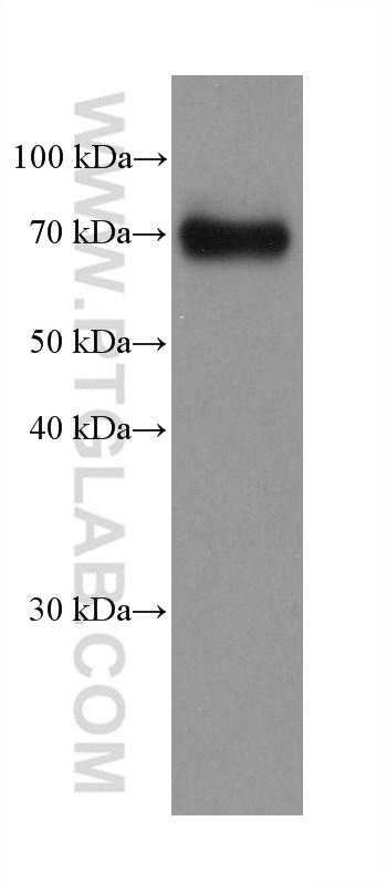 WB analysis of HeLa using 68120-1-Ig (same clone as 68120-1-PBS)