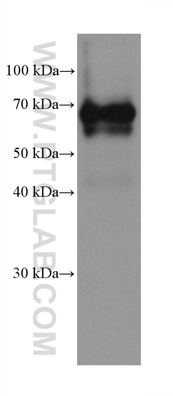 WB analysis of rat heart using 68120-1-Ig (same clone as 68120-1-PBS)