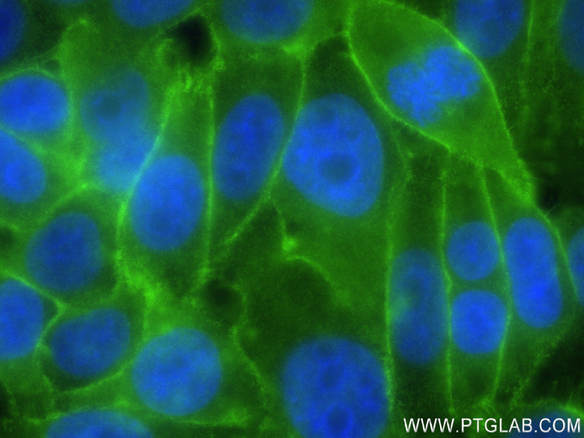 IF Staining of HepG2 using 83609-5-RR
