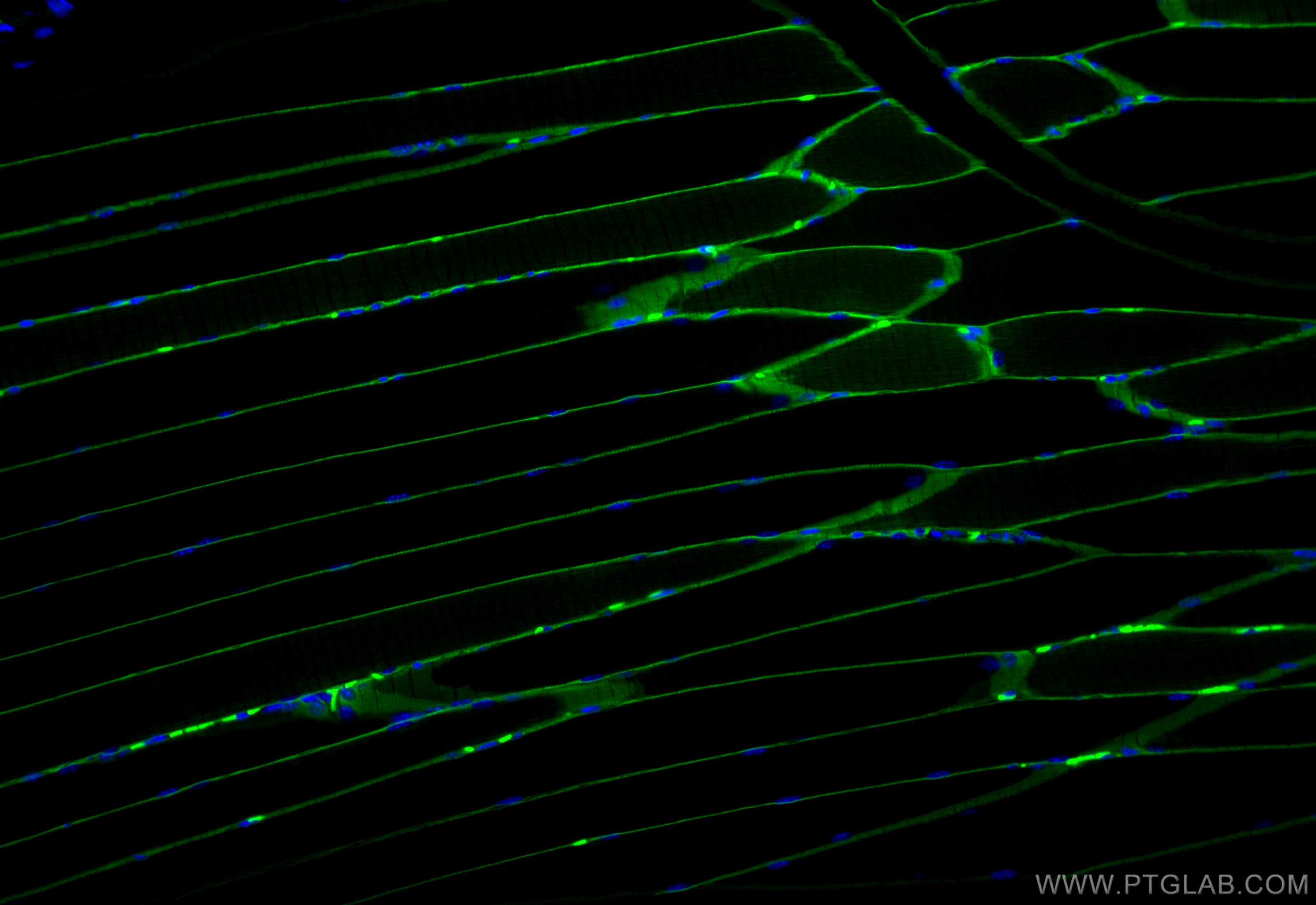 IF Staining of mouse skeletal muscle using CL488-83609-5