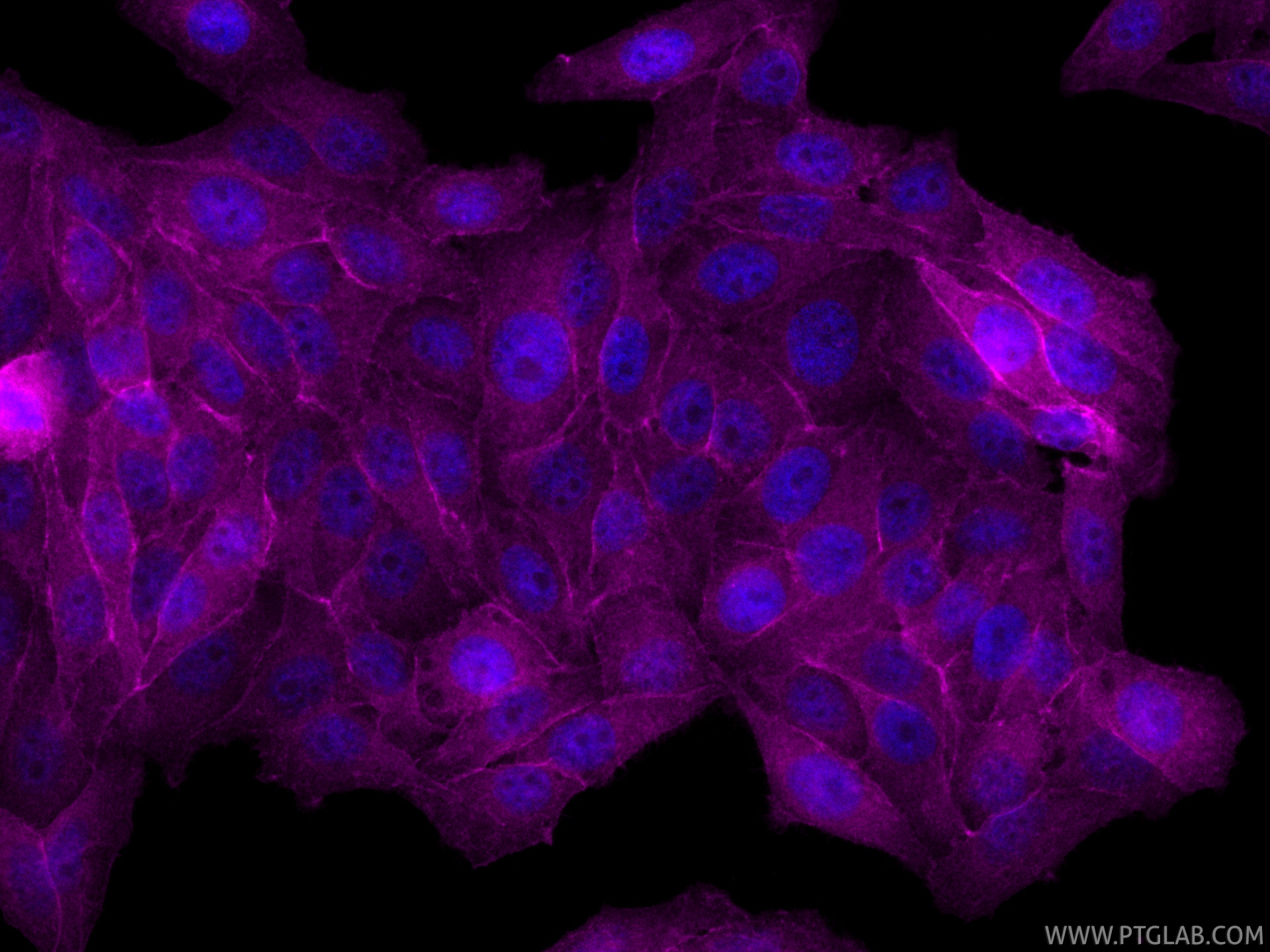 IF Staining of HepG2 using CL647-83609-6