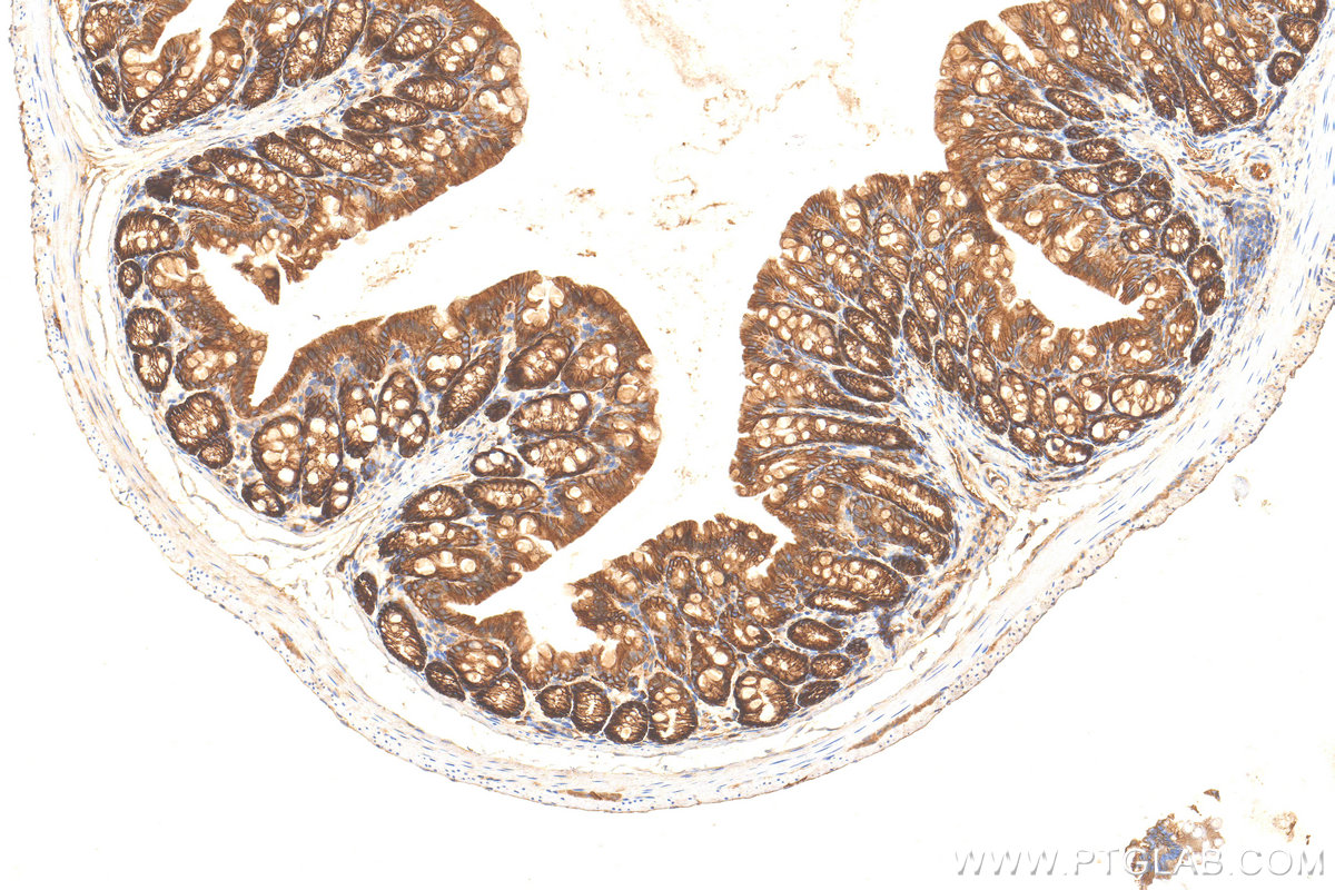IHC staining of mouse colon using 31863-1-AP