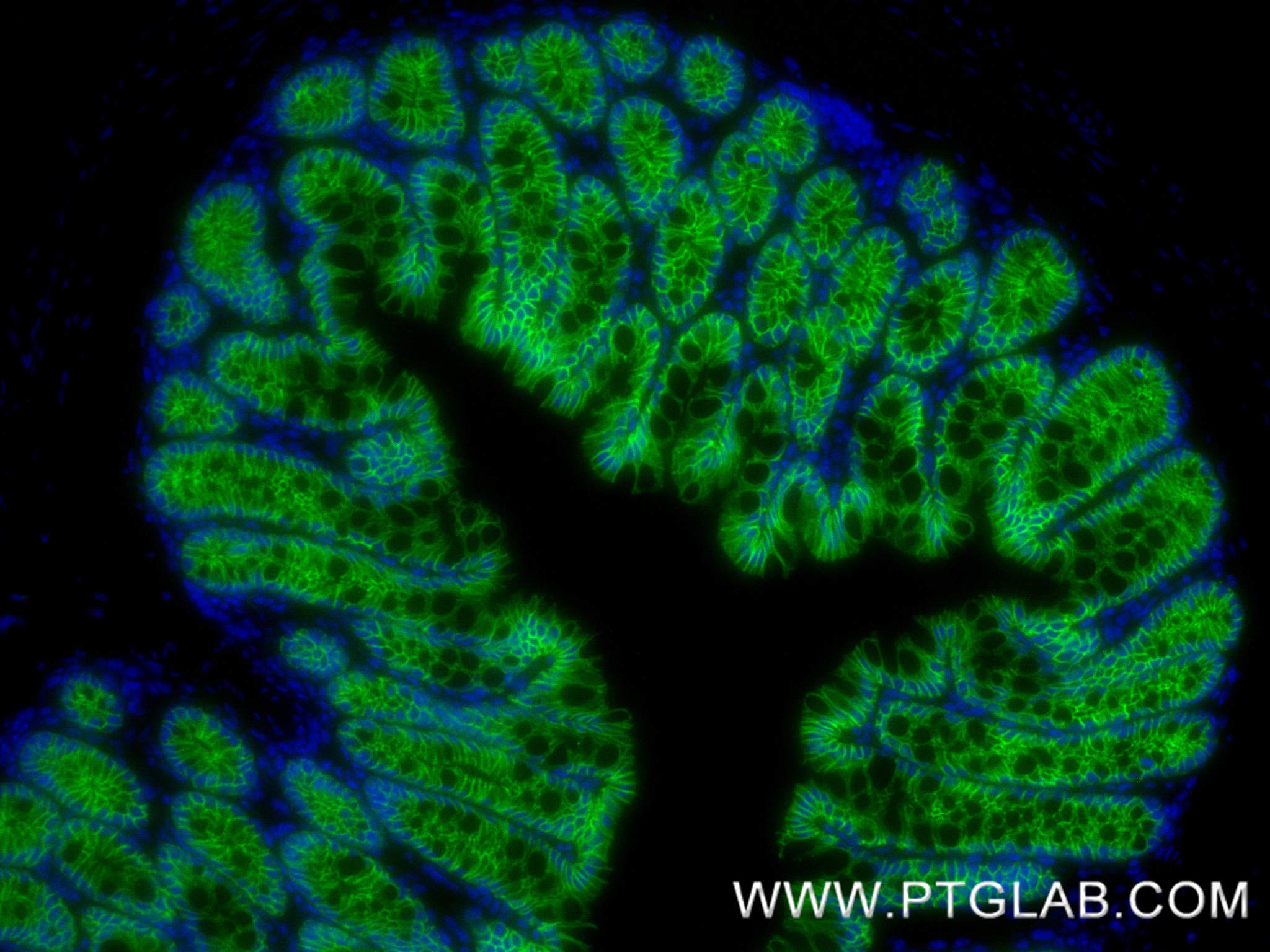 IF Staining of mouse colon using 84111-1-RR (same clone as 84111-1-PBS) IF Staining of mouse colon using 84111-1-RR (same clone as 84111-1-PBS)