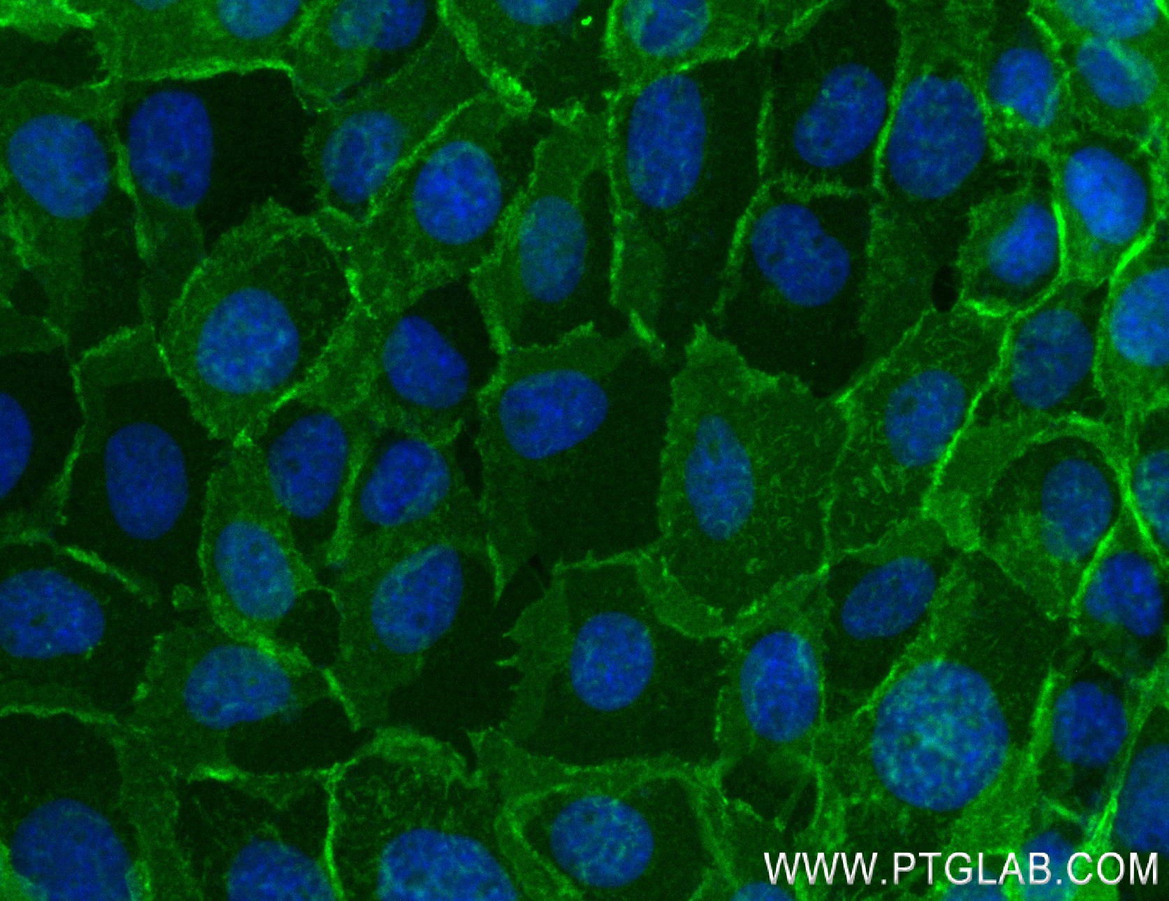 IF Staining of A431 using 84111-2-RR