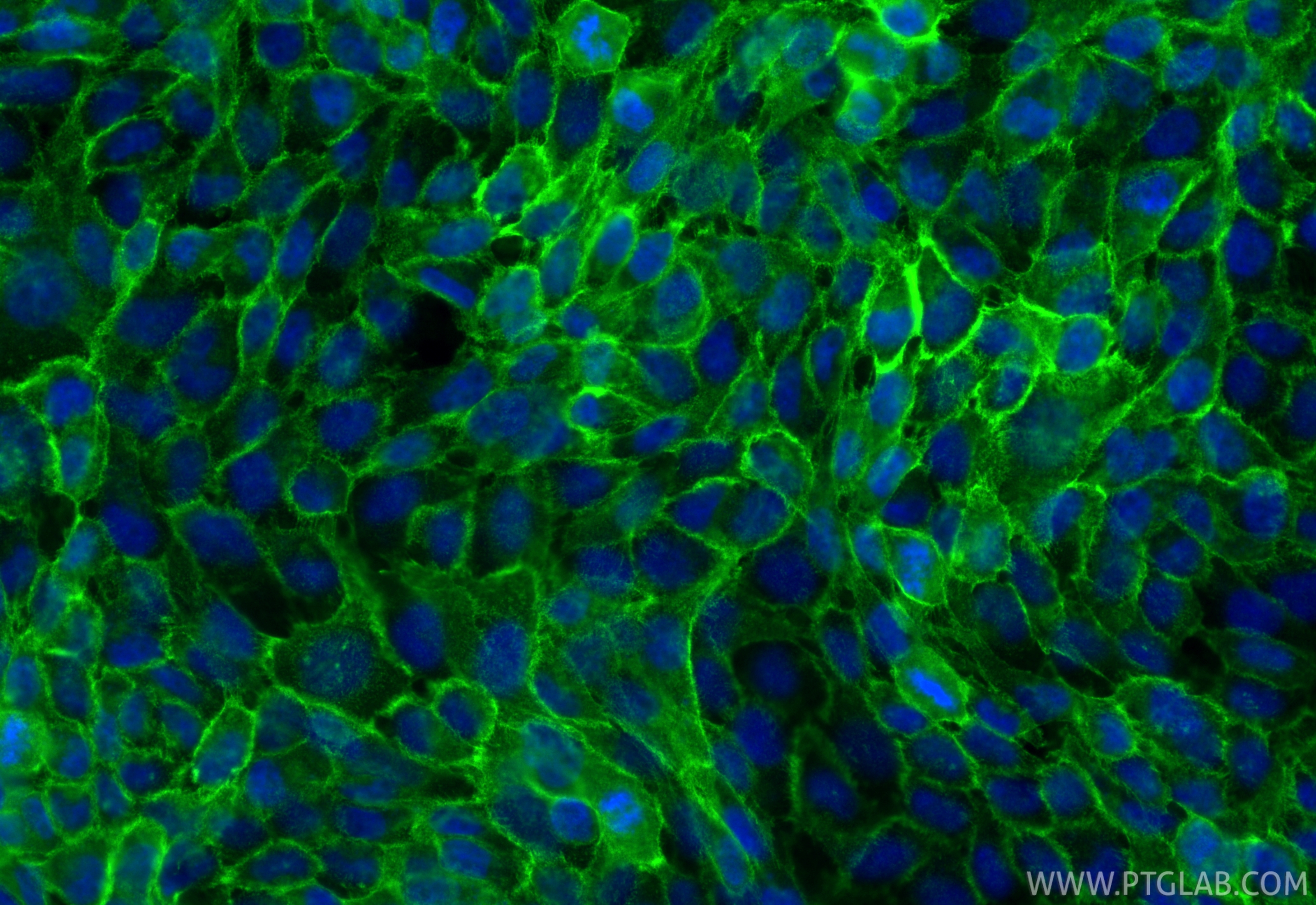 Immunofluorescent analysis of (4% PFA) fixed A431 cells using E-cadherin antibody (<a class='green' href='/productredirect?CatalogNo=84111-2-RR' target='_blank'>84111-2-RR</a>, Clone: 241282A8 ) at dilution of 1:500 and CoraLite®488-Conjugated Goat Anti-Rabbit IgG(H+L) (<a class='green' href='/productredirect?CatalogNo=SA00013-2' target='_blank'>SA00013-2</a>). This data was developed using the same antibody clone with 84111-2-PBS in a different storage buffer formulation. IF Staining of A431 using 84111-2-RR (same clone as 84111-2-PBS)
