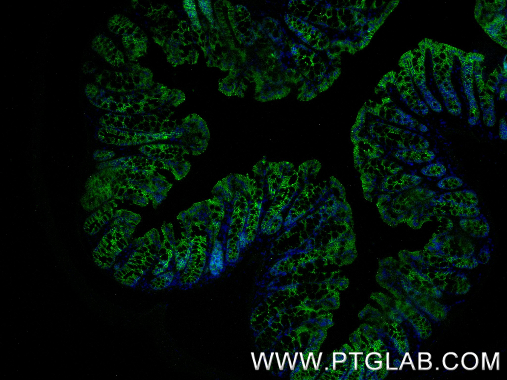IF Staining of mouse colon using 84646-4-RR