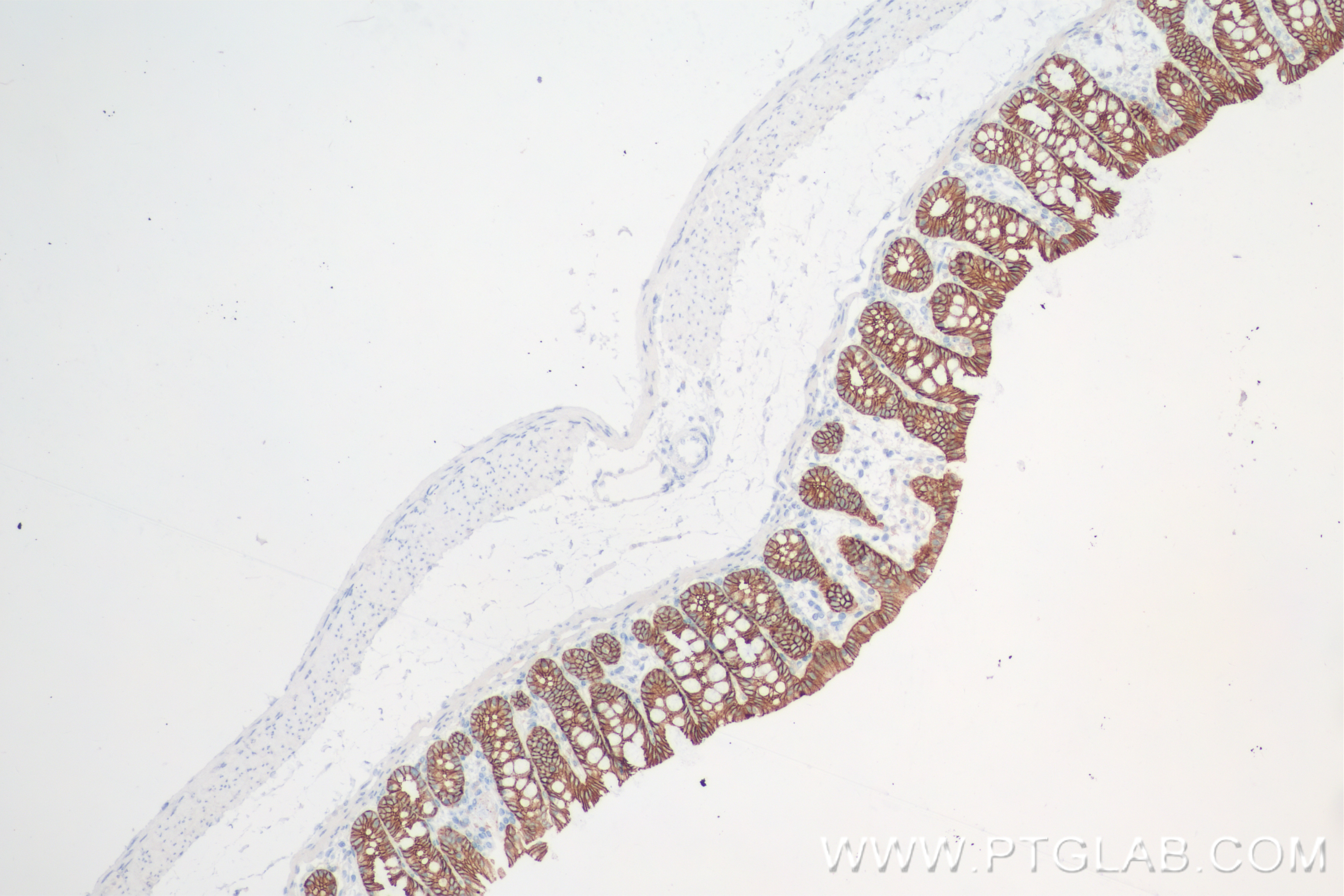 IHC staining of rat colon using 84646-4-RR