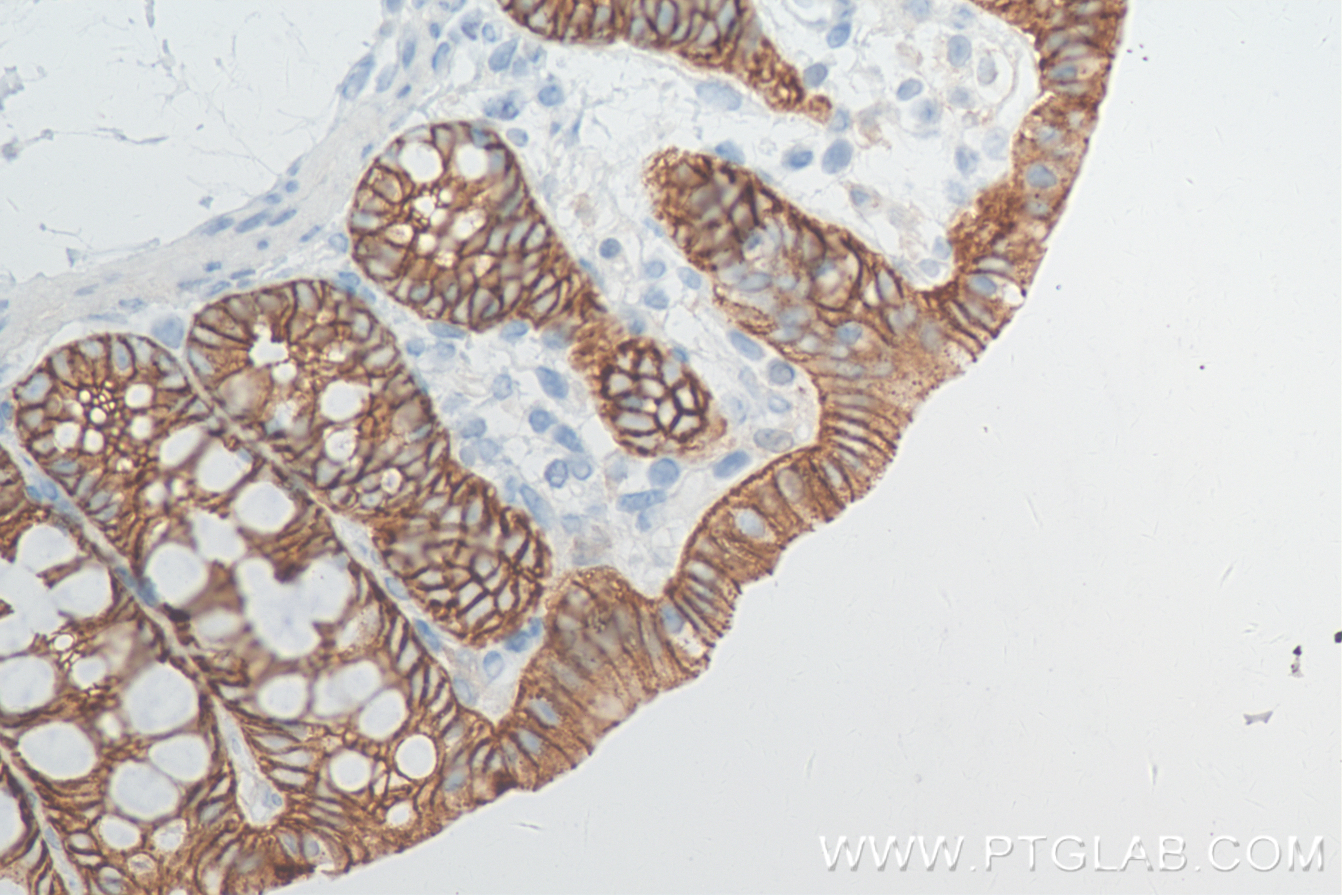 IHC staining of rat colon using 84646-4-RR