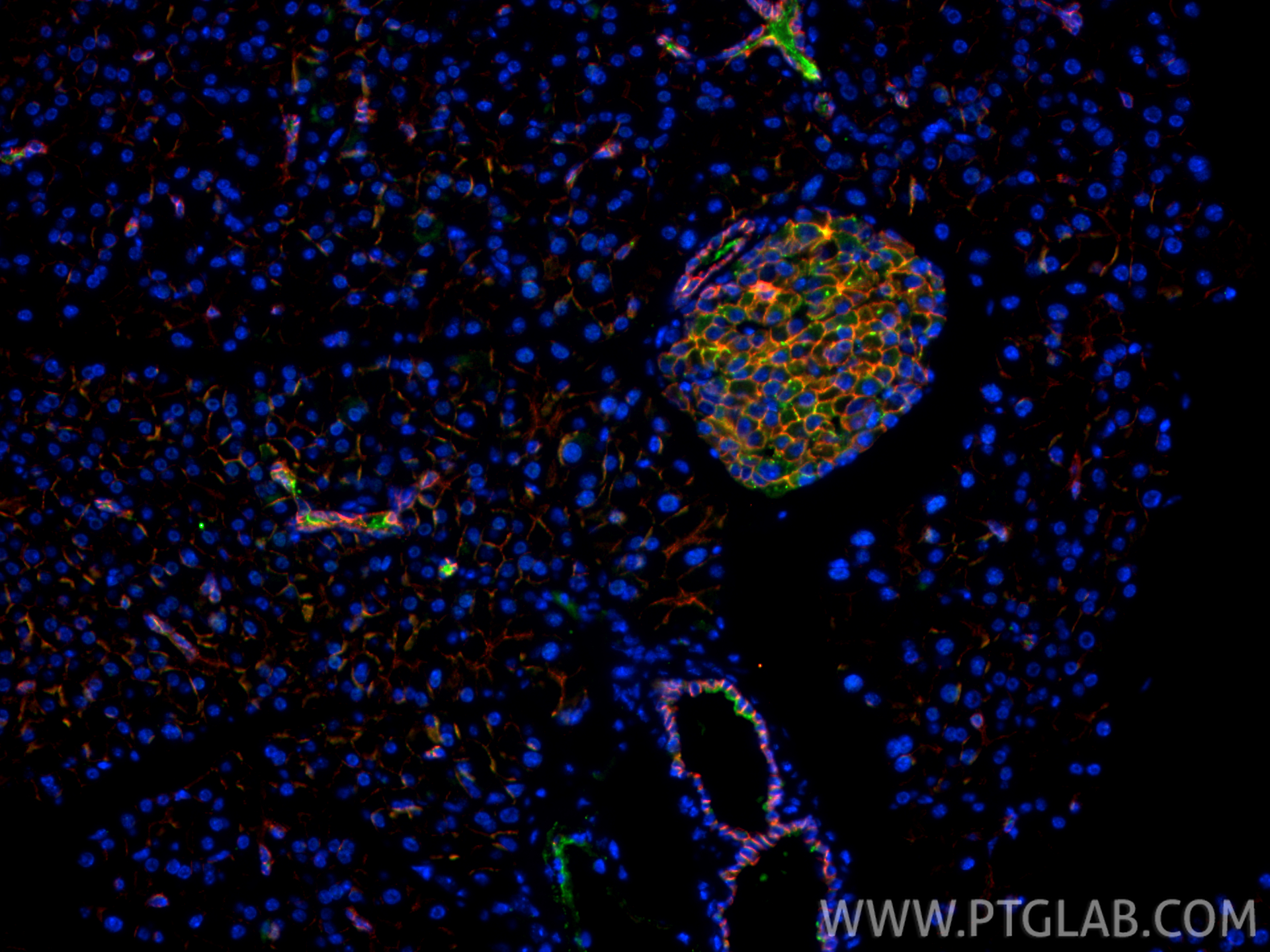 IF Staining of mouse pancreas using 20874-1-AP
