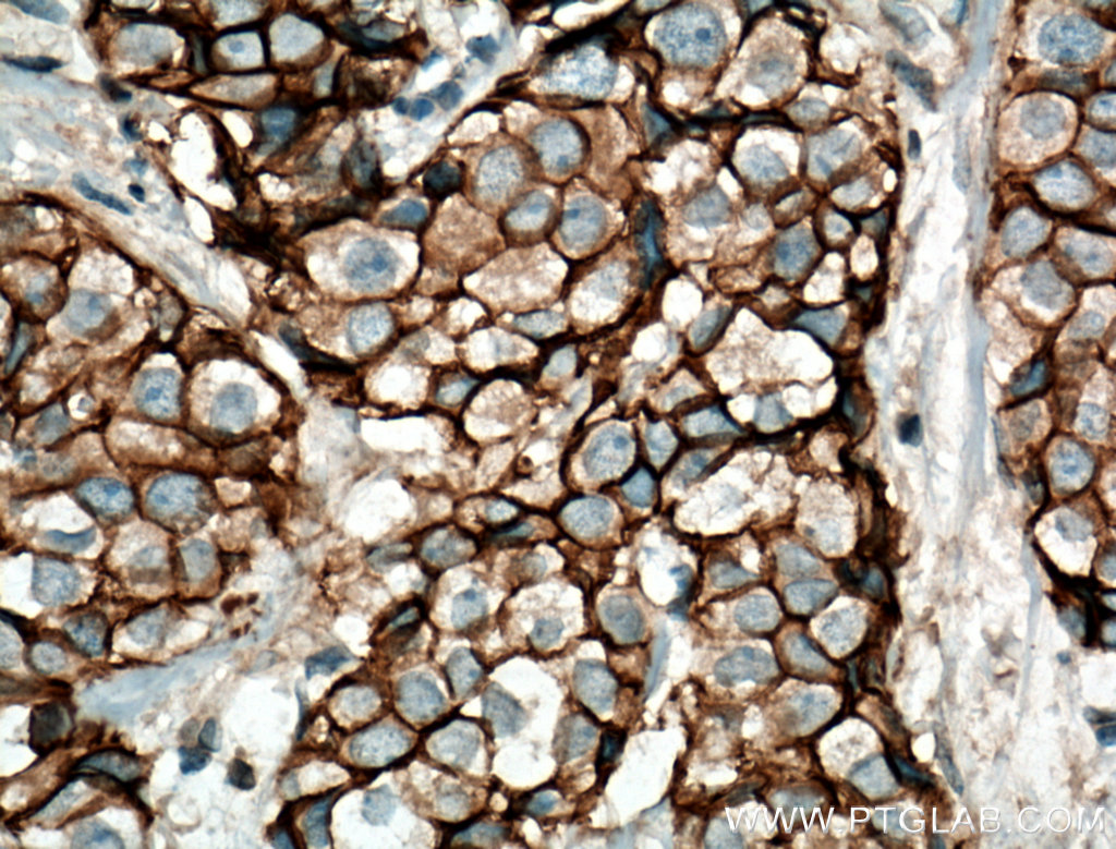vinculin-antibody-26520-1-ap-proteintech
