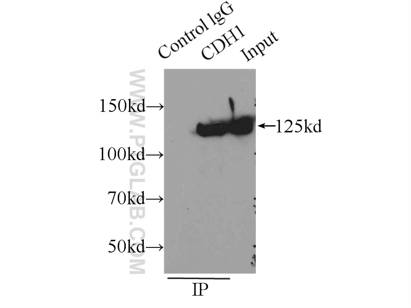 IP experiment of A431 using 20874-1-AP