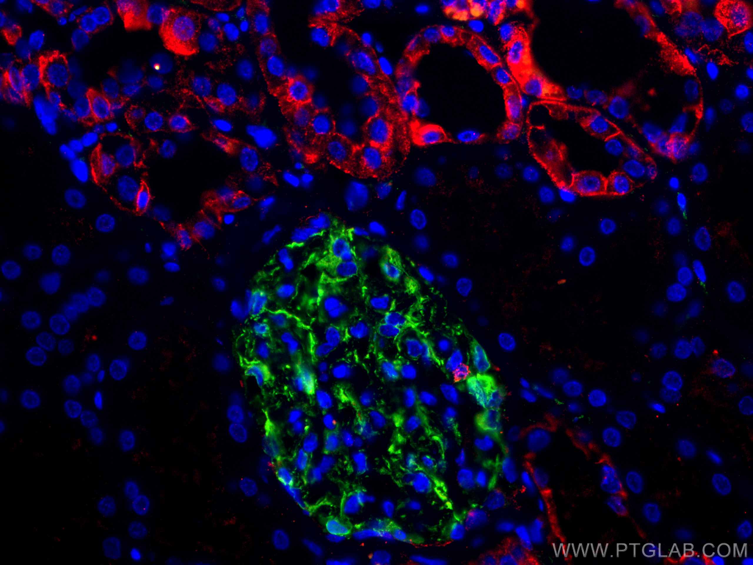 IF Staining of human kidney using 60335-1-Ig (same clone as 60335-1-PBS)