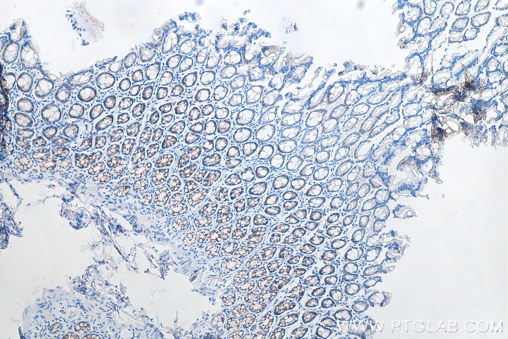 IHC staining of rat colon using 60335-1-Ig