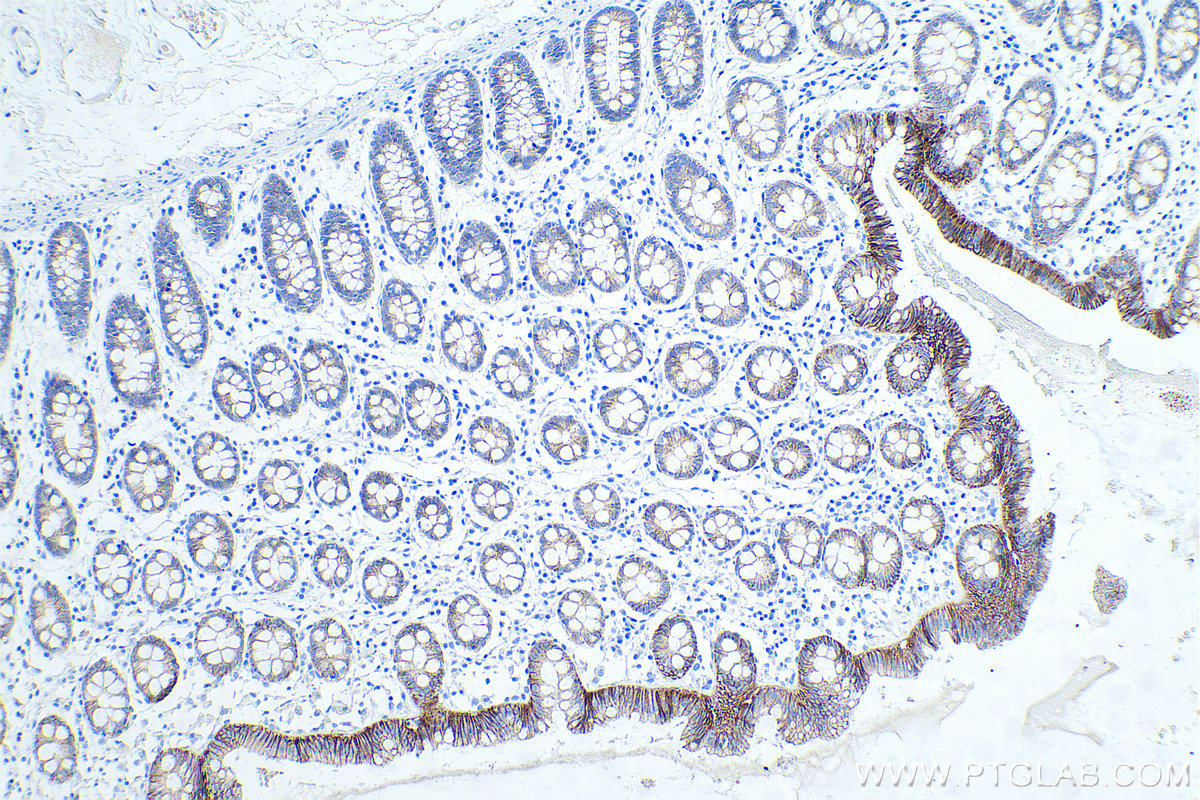 IHC staining of human colon using 60335-1-Ig
