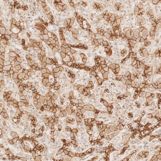 IHC staining of human liver using 60335-1-Ig