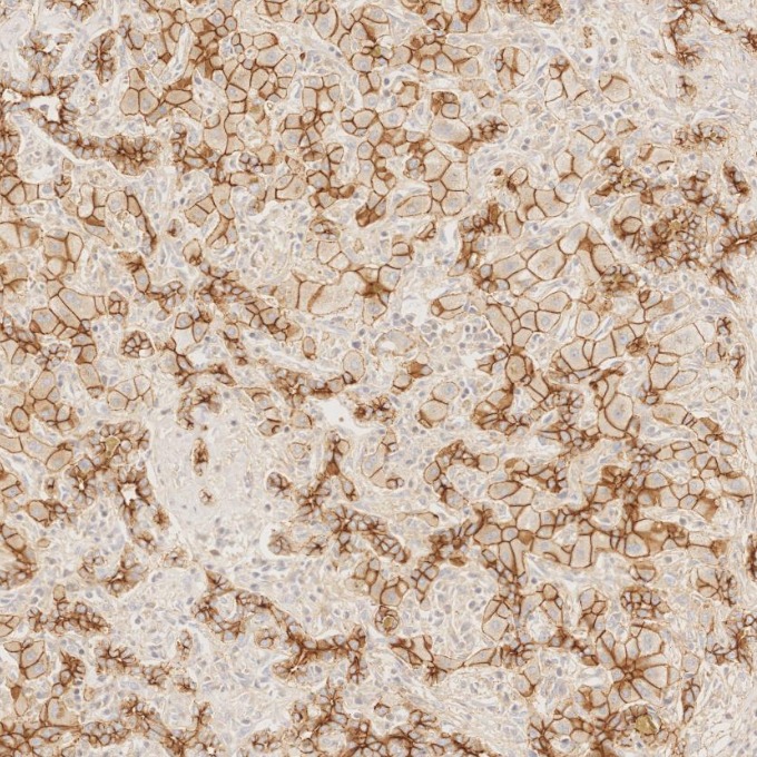 IHC staining of human liver using 60335-1-Ig