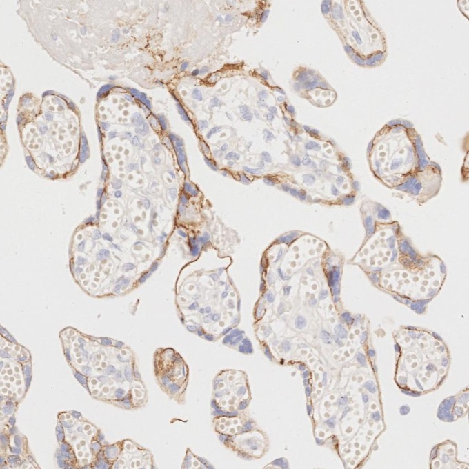 IHC staining of human placenta using 60335-1-Ig