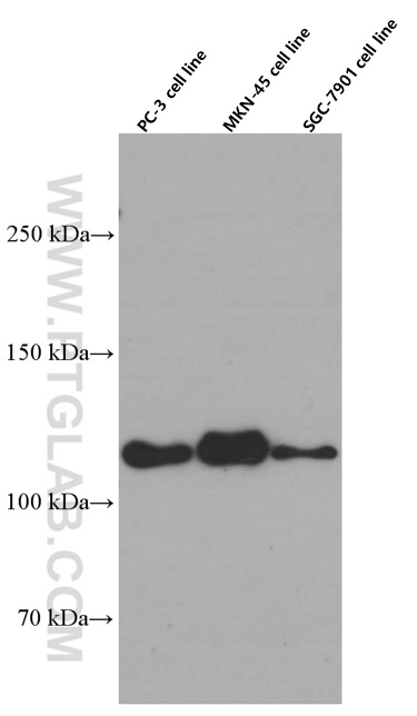 E-cadherin Monoclonal antibody