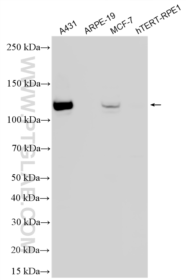 WB analysis using 60335-1-Ig
