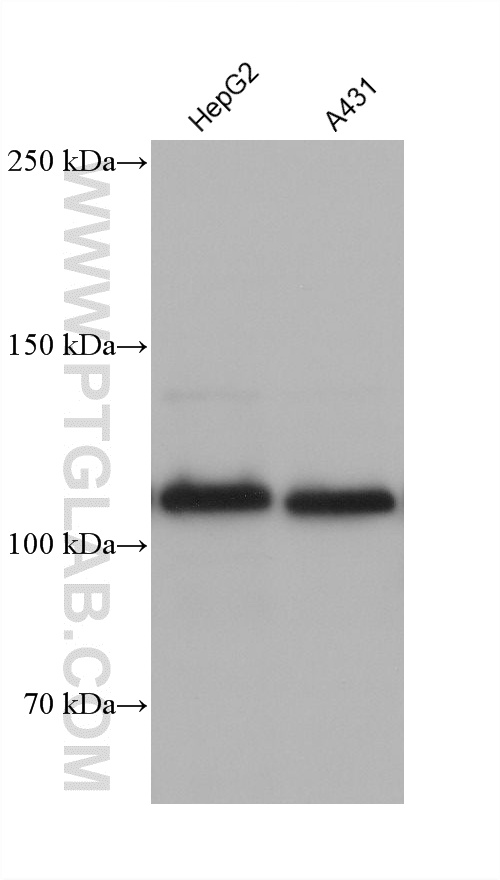 WB analysis using 60902-1-Ig (same clone as 60902-1-PBS)