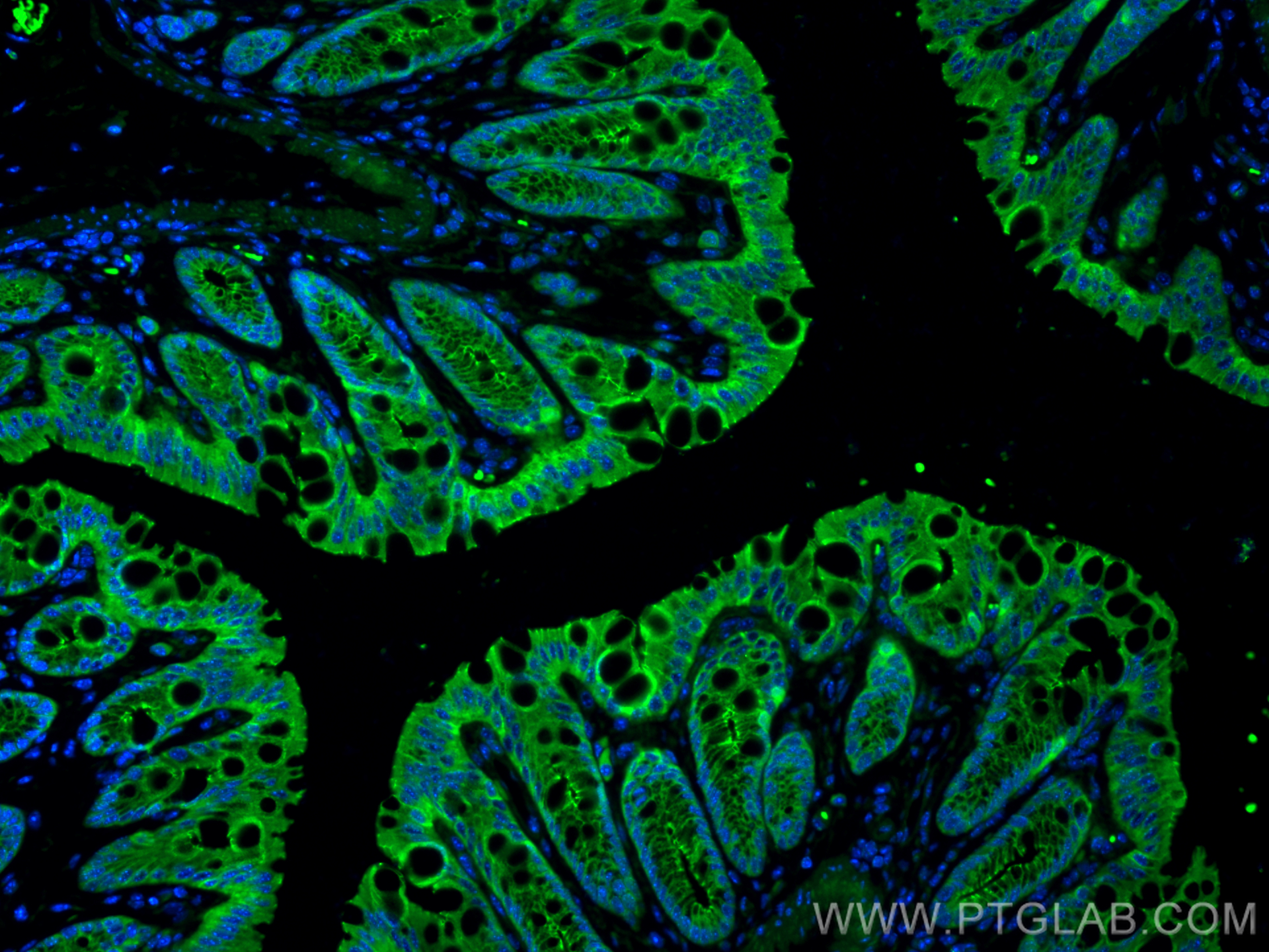 IF Staining of mouse colon using 65241-1-Ig