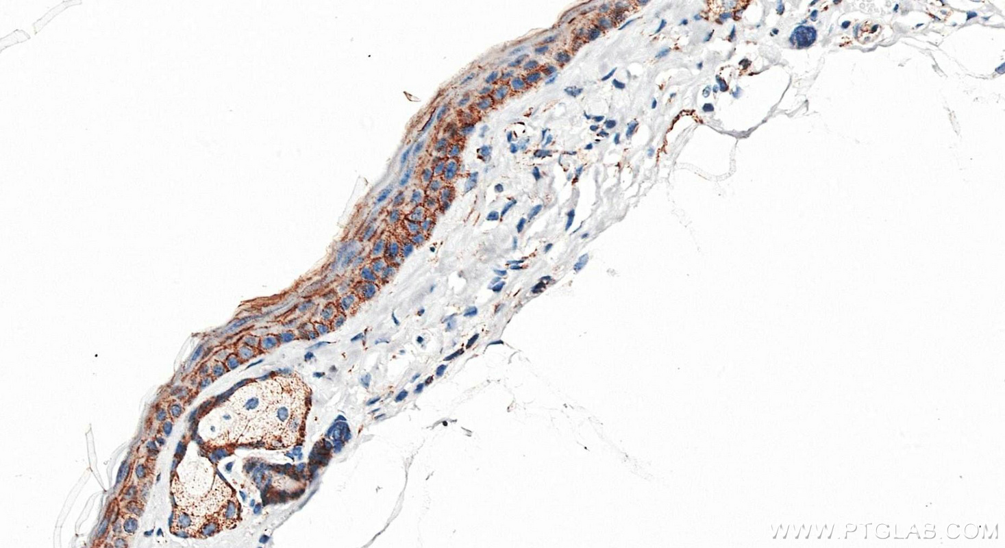 IHC staining of mouse skin using 80541-5-RR