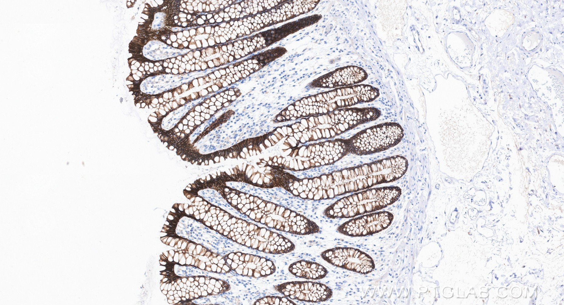 IHC staining of human large intestine using 80541-5-RR IHC staining of human large intestine using 80541-5-RR