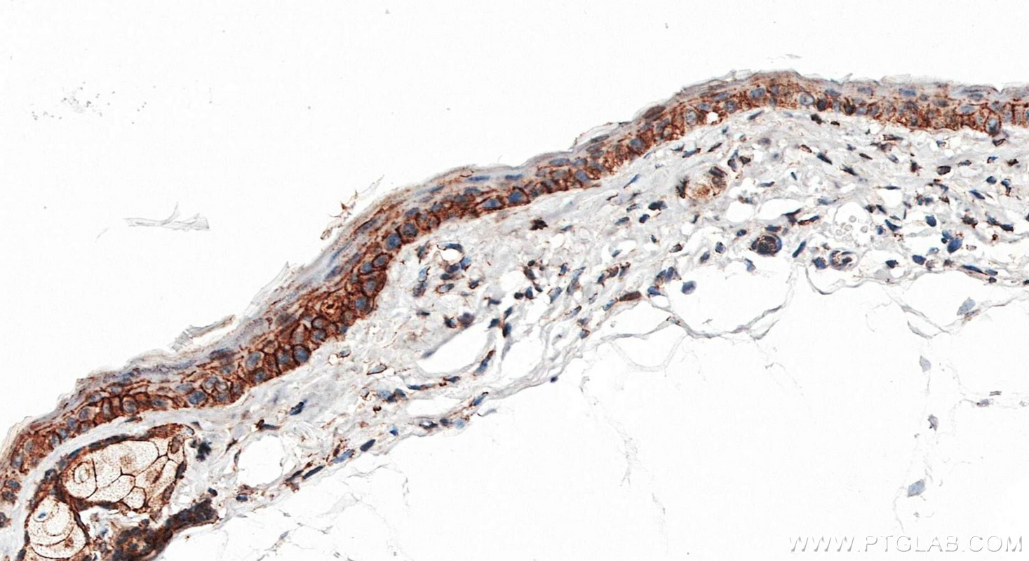IHC staining of mouse skin using 80541-7-RR IHC staining of mouse skin using 80541-7-RR
