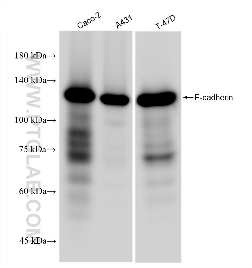 E-cadherin