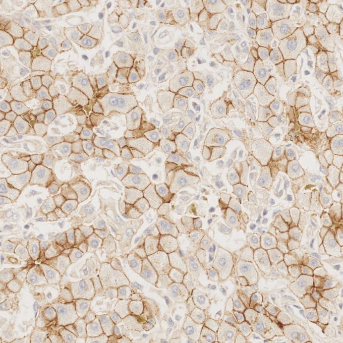 IHC staining of human liver using 83991-4-RR IHC staining of human liver using 83991-4-RR