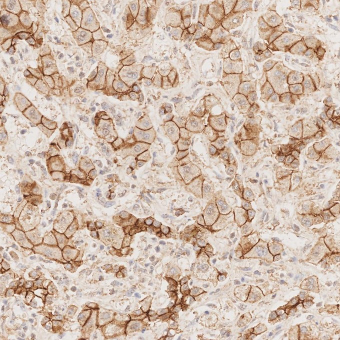 IHC staining of human liver using 83991-4-RR IHC staining of human liver using 83991-4-RR