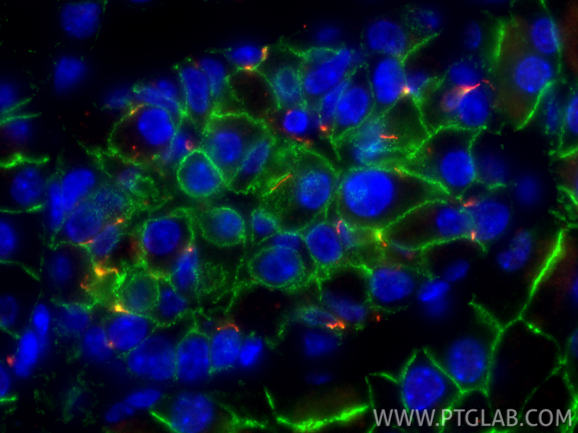 Immunofluorescent analysis of (4% PFA) fixed paraffin-embedded mouse pancreas tissue using CoraLite® Plus 488 E-cadherin antibody (CL488-20874) at dilution of 1:200, ARL13B antibody (<a class='green' href='/productredirect?CatalogNo=17711-1-AP' target='_blank'>17711-1-AP</a>, red). Heat mediated antigen retrieval with Tris-EDTA buffer (pH 9.0). IF Staining of mouse pancreas using CL488-20874