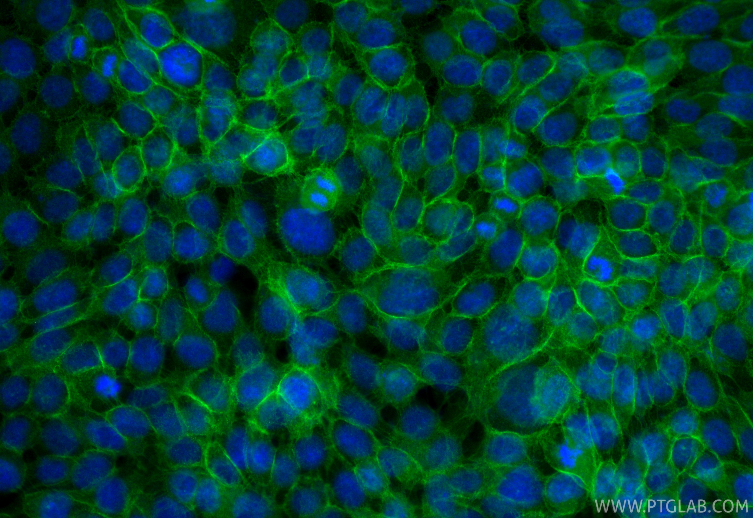 IF Staining of A431 using CL488-20874 IF Staining of A431 using CL488-20874