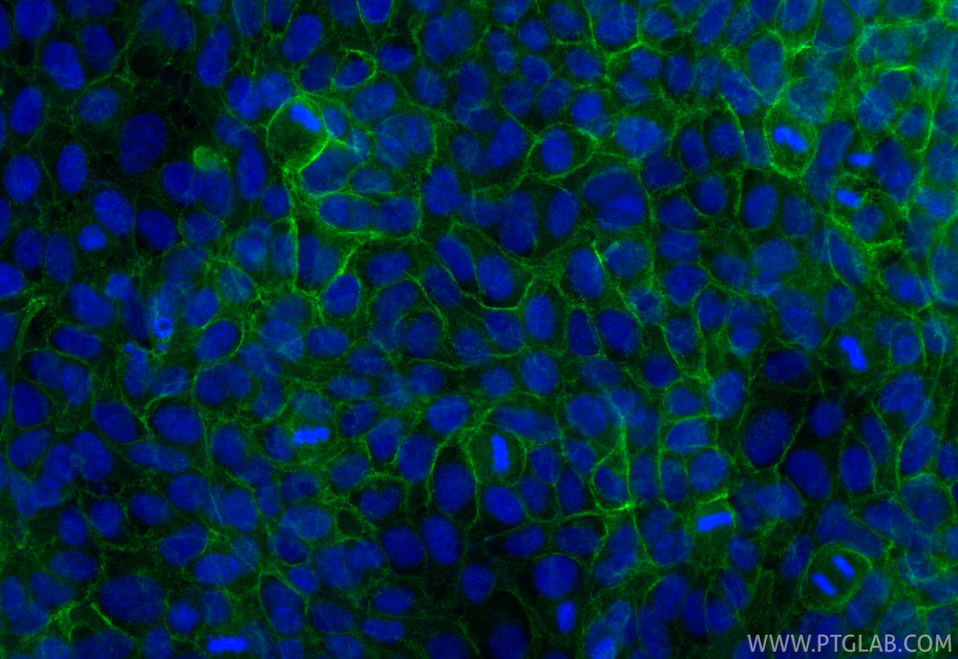 Immunofluorescent analysis of (-20°C Methanol) fixed A431 cells using CoraLite® Plus 488 E-cadherin antibody (CL488-84111-2, Clone: 241282A8 ) at dilution of 1:200. IF Staining of A431 using CL488-84111-2