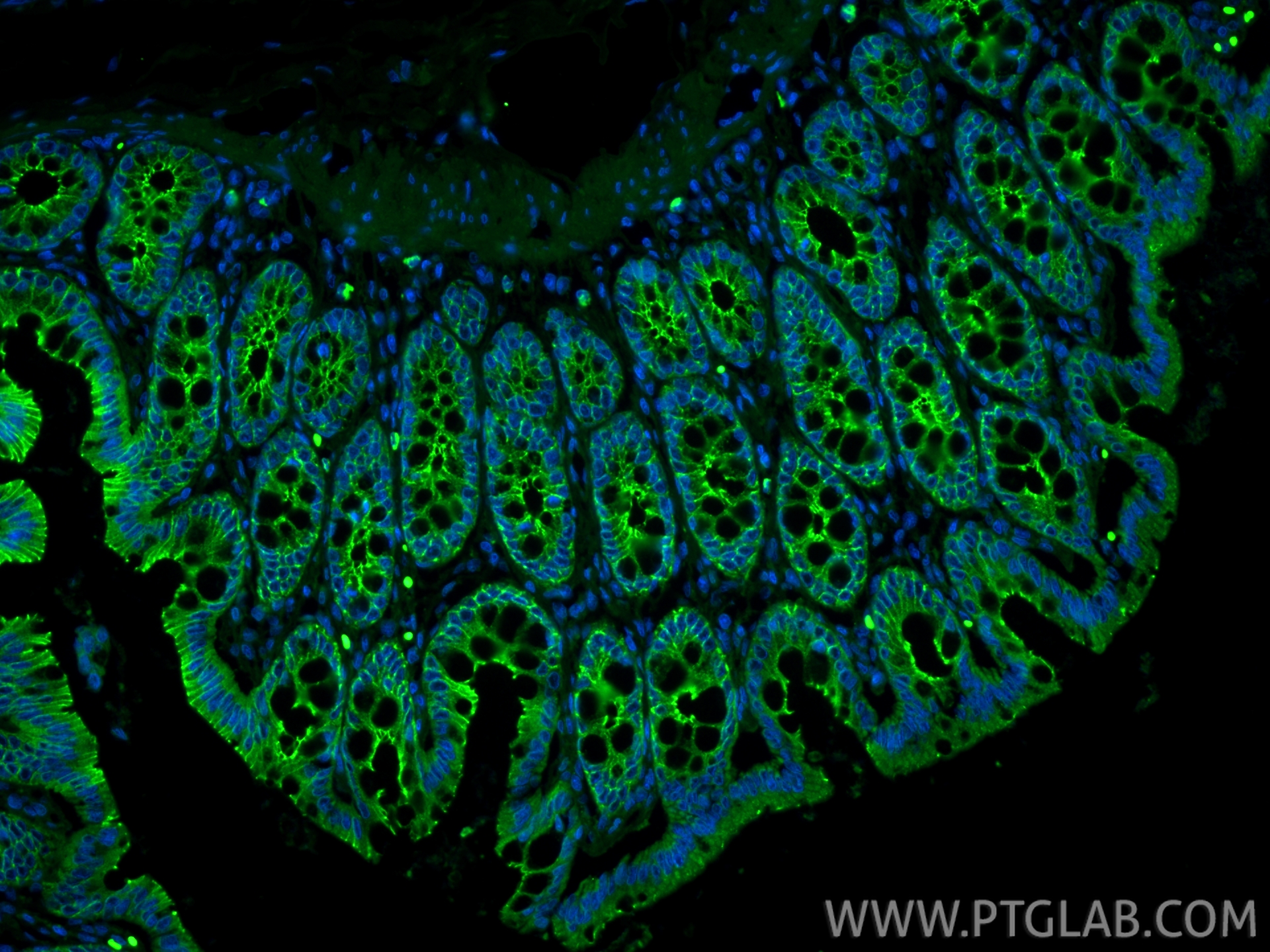 Immunofluorescent analysis of (4% PFA) fixed paraffin-embedded rat colon tissue using CoraLite® Plus 488 E-cadherin antibody (CL488-84646-3, Clone: 242018D3 ) at dilution of 1:200. Heat mediated antigen retrieval with Tris-EDTA buffer (pH 9.0). IF Staining of rat colon using CL488-84646-3