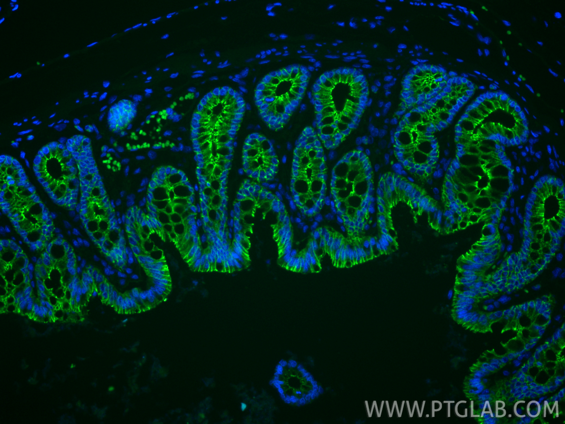 Immunofluorescent analysis of (4% PFA) fixed paraffin-embedded rat colon tissue using CoraLite® Plus 488 E-cadherin antibody (CL488-84646-4, Clone: 242018C10 ) at dilution of 1:200. Heat mediated antigen retrieval with Tris-EDTA buffer (pH 9.0). IF Staining of rat colon using CL488-84646-4