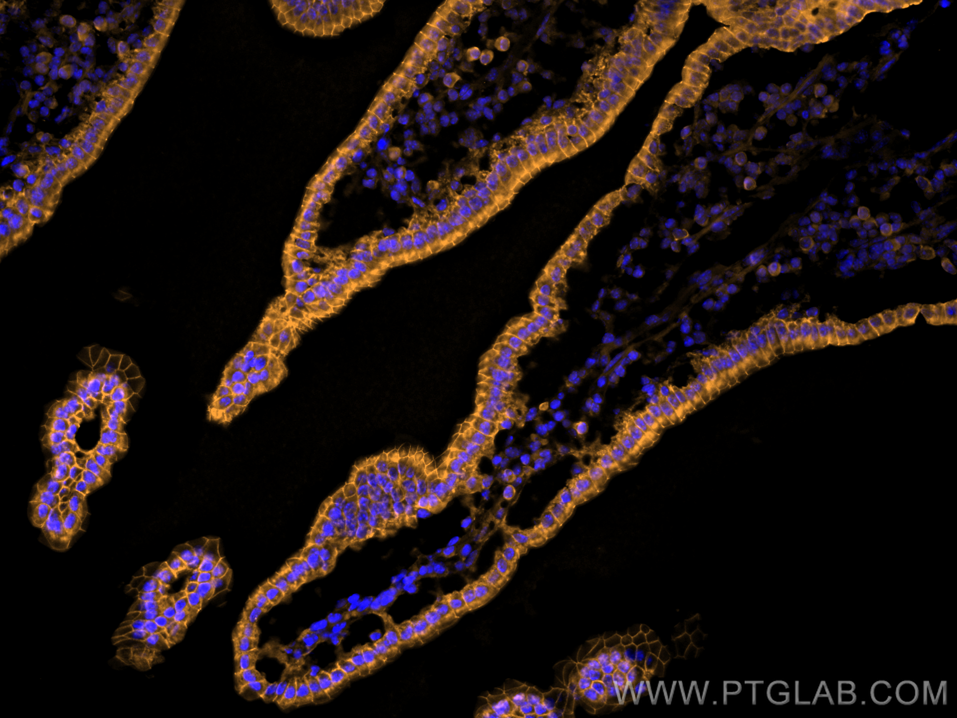 IF Staining of mouse small intestine using CL555-60335