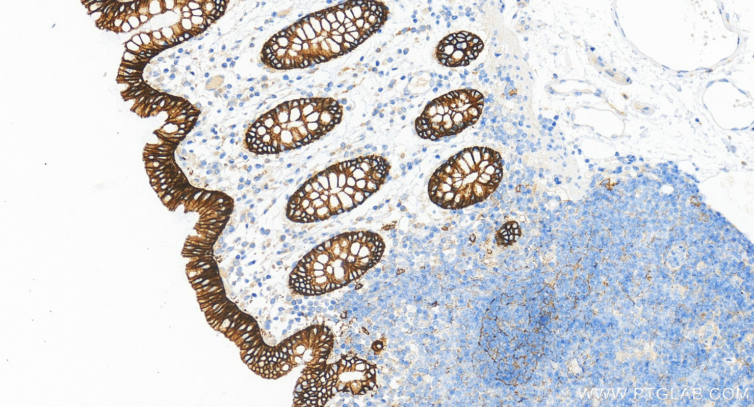 IHC staining of human colon using RMX00039