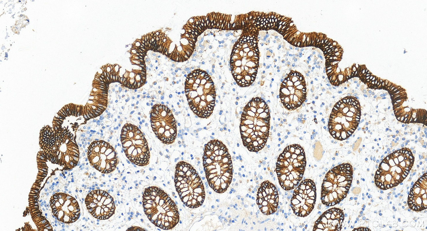 IHC staining of human colon using RMX00039