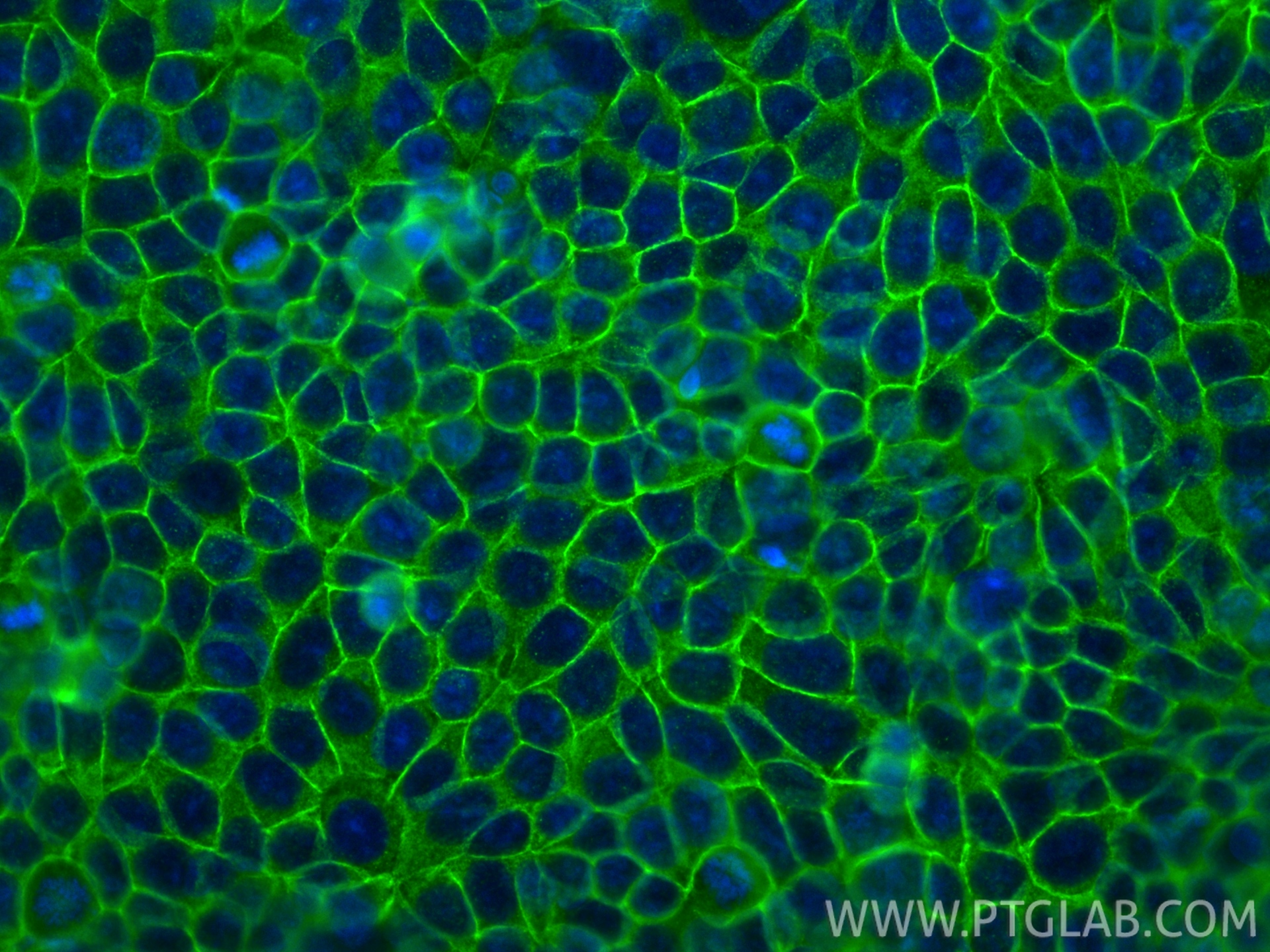IF Staining of MCF-7 using RMX00039